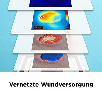 Vernetzte Wundversorgung – ambulante Pflege, Hausärzt:innen & Wundspezialist:innen arbeiten Hand in Hand mithilfe von cureVision